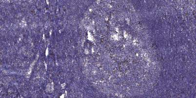 ITF Polyclonal Rabbit pAb 50µL/100µL