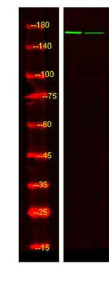 IGF-I Receptor β (phospho-Tyr980) rabbit pAb
