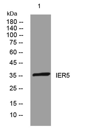 IER5 rabbit pAb 50µL/100µL