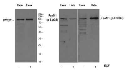 FoxM1 (phospho-Thr600) rabbit pAb