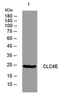 CLC4E rabbit pAb