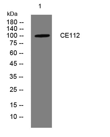 CE112 rabbit pAb 50µL/100µL