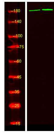 ALK (phospho-Tyr1078) rabbit pAb