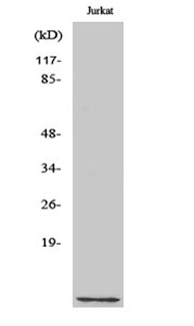 Cks1 rabbit pAb 50µL/100µL