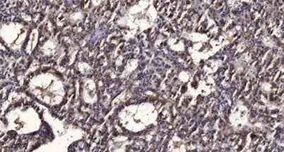 PPAR α (Phospho Ser21) rabbit pAb