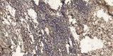 Rb (Phospho Thr252) rabbit pAb