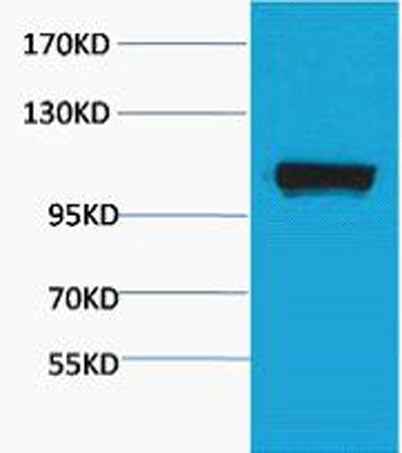 PEPC rabbit pAb