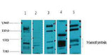 Glucocorticoid receptor rabbit pAb