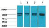 Estrogen Receptor α rabbit pAb
