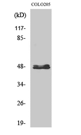 CYP11B1/2 rabbit pAb 50µL/100µL