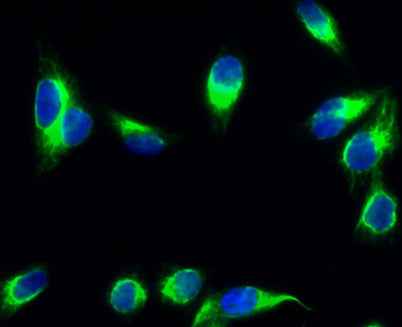CYP19A1 rabbit pAb