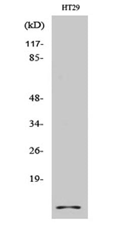 Cystatin A rabbit pAb 50µL/100µL