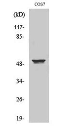 Cytokeratin 8 rabbit pAb
