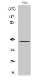 HORMAD1 rabbit pAb 50µL/100µL