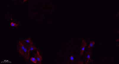 Integrin β3 rabbit pAb