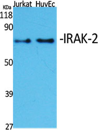 IRAK-2 rabbit pAb 50µL/100µL