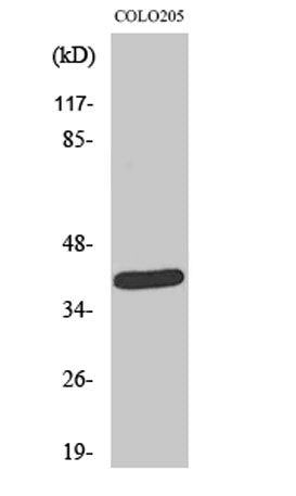 NEGR1 rabbit pAb 50µL/100µL
