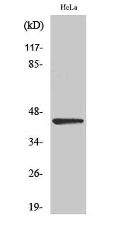 NEIL1 rabbit pAb 50µL/100µL