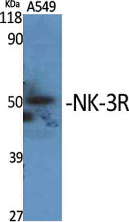 NK-3R rabbit pAb