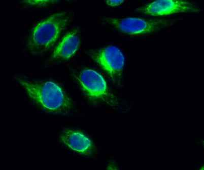 PKD1 rabbit pAb