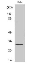 Ribosomal Protein S2 rabbit pAb