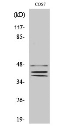 Sox-8/9/17/18 rabbit pAb 50µL/100µL