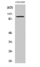 Synphilin-1 rabbit pAb 50µL/100µL