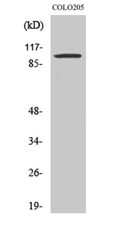 Synphilin-1 rabbit pAb 50µL/100µL