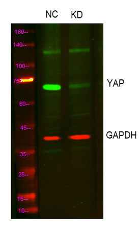 YAP rabbit pAb