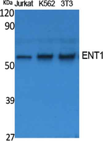 ENT1 rabbit pAb