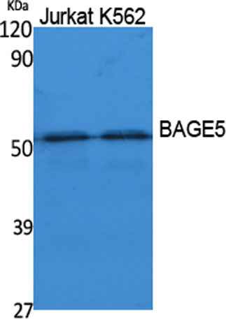 BAGE5 rabbit pAb