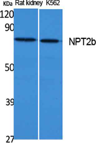 NPT2b rabbit pAb
