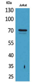 Prothrombin rabbit pAb