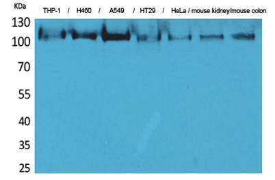 cPLA2 rabbit pAb 50µL/100µL
