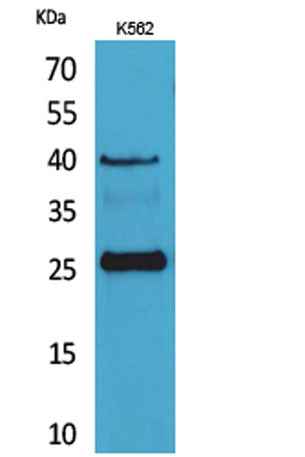 CD161 rabbit pAb