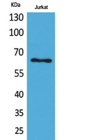Keratin-pan rabbit pAb 50µL/100µL