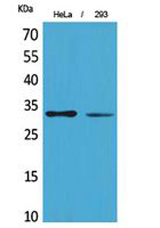 SDHB rabbit pAb 50µL/100µL