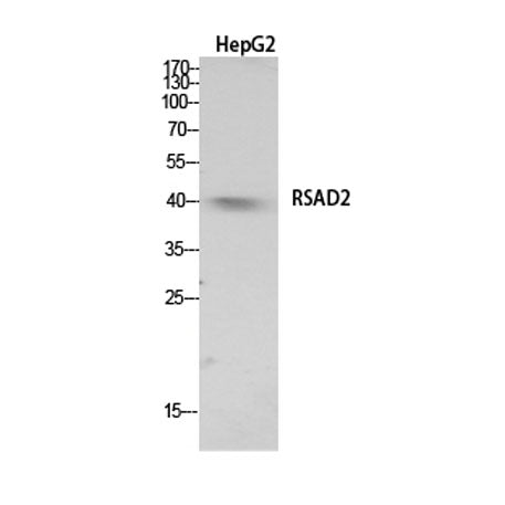 RSAD2 rabbit pAb 50µL/100µL