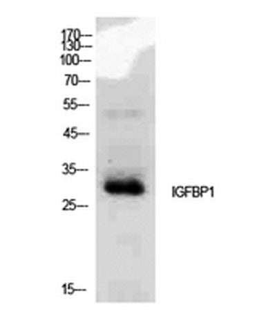 IGFBP1 rabbit pAb 50µL/100µL