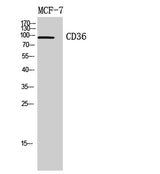 CD36 rabbit pAb 50µL/100µL