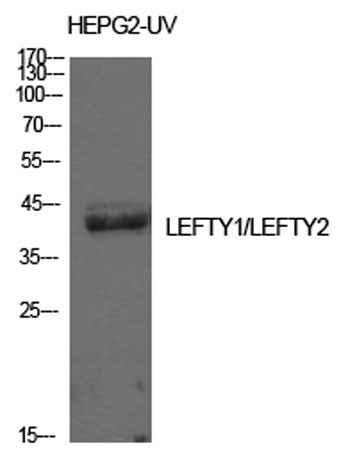 Lefty rabbit pAb