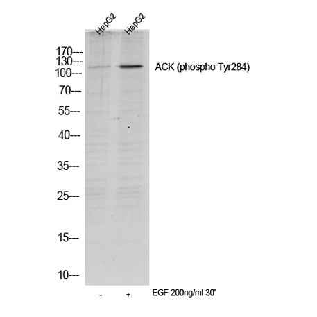 ACK (phospho Tyr284) rabbit pAb