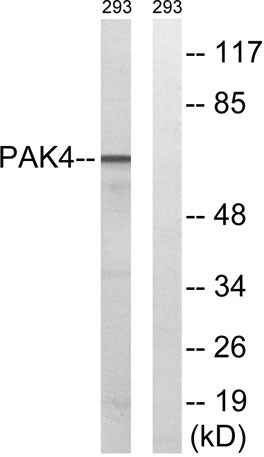 PAK4/5/6 rabbit pAb