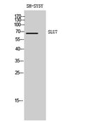 SLU7 rabbit pAb 50µL/100µL