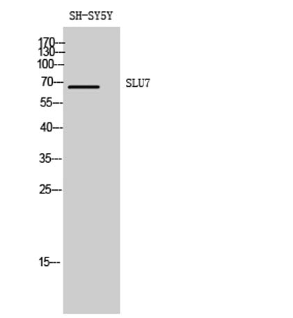 SLU7 rabbit pAb 50µL/100µL