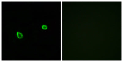 IREβ rabbit pAb 50µL/100µL