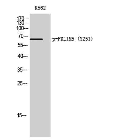 PDLIM5 (phospho Tyr251) rabbit pAb