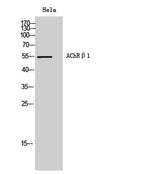 AChRβ1 rabbit pAb