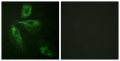 ADD1 rabbit pAb 50µL/100µL