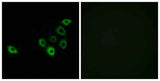 Olfactory receptor 51S1 rabbit pAb